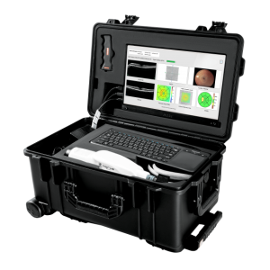 MiiS Horus Scope Optical Coherence Tomography ACT100